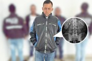 Mediante una radiografía se comprobó que el sospechoso tenía la cadena en su intestino.