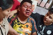 El día de la agresión así encontraron a Italo Sabino Cruz Macías.