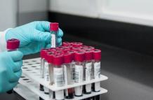 muestra de sangre (1)