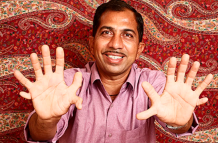 El hombre de 43 años tiene 28 dedos y dice que es una bendición.