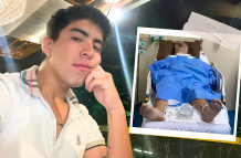 Quemado accidente motocicleta