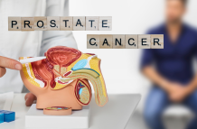 cáncer de prostata