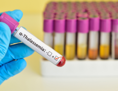 Talasemia
