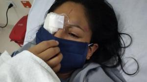 La cotopaxense Jéssica Caicedo Mullo fue atacado en octubre pasado.