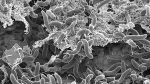 Unas moléculas protectoras presentes en el moco podrían prevenir el cólera