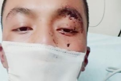 El hombre fue apuñalado por uno de los tipos que entró al sitio donde él laboraba. Por fortuna, la herida fue superficial.