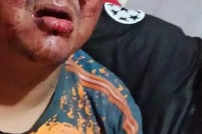 El día de la agresión así encontraron a Italo Sabino Cruz Macías.