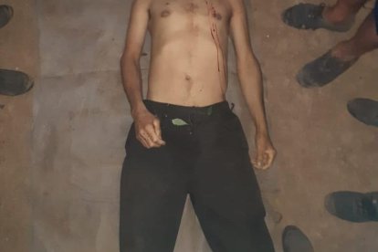 Una de las víctimas fue llevada al Centro Forense de la ciudad de Manta.