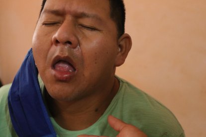 A Cruz le sacaron partes de los bordes del órgano para la reconstrucción.