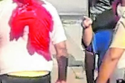 Sacerdote sufrió varias heridas durante el robo. El delincuente lo atacó con un destornillador.