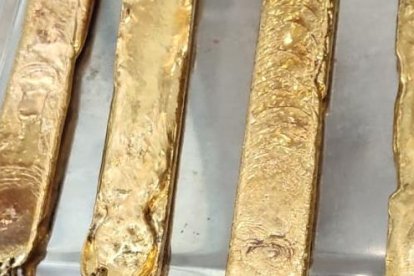 Cuatro barras de oro fueron extraídas del cuerpo del ciudadano.