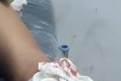 A la mujer le cortaron la mano con un machete.