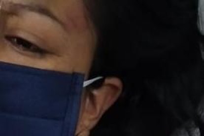 La cotopaxense Jéssica Caicedo Mullo fue atacado en octubre pasado.