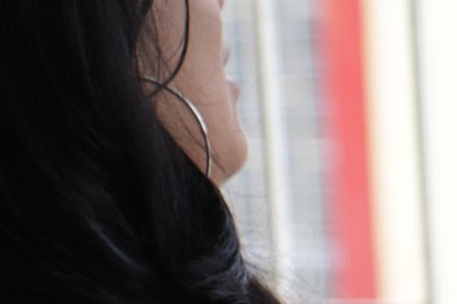 En los brazos de la mujer atacada por dos delincuentes aún se observan las huellas de la agresión. Teme salir de casa.