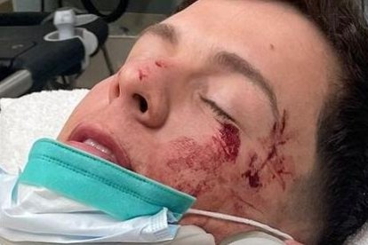 El cantante se encuentra estable luego del siniestro provocado por otro conductor.