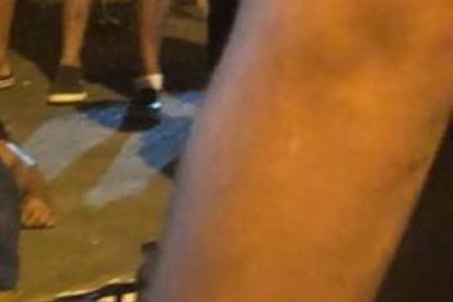 En medio de la desesperación, unos moradores buscaban atención para Ronald Alarcón.