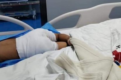 Los glúteos del pequeño permanecen vendados. El niño se encuentra estable.