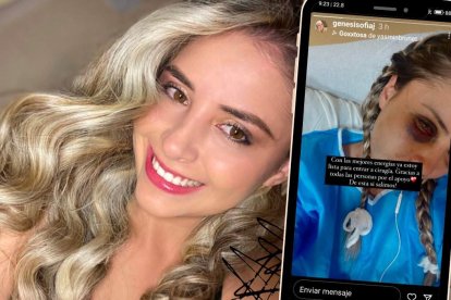 Génesis Jaramillo se operó el rostro este miércoles 26 de abril.