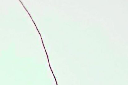 Una caminata, trotar, saltar la cuerda sirven para ejercitarse.