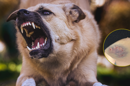 La joven fue mordida por un perro en su glúteo derecho.