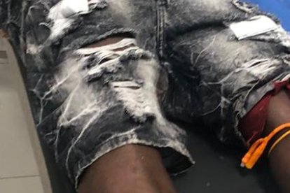 El hombre quedó herido en una pierna y fue llevado hacia un hospital cercano al Trinipuerto.