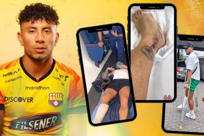 Joao Rojas y su tercera gran lesión, en pocos meses volverá.