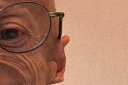 Dedicó su vida al estudio y reconocimiento de su enfermedad.