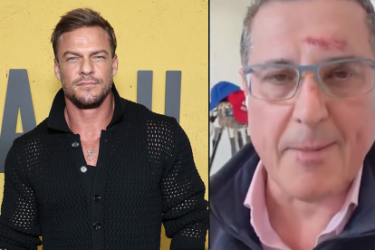 El actor Alan Ritchson protagonizó un altercado con un vecino en Nashville que terminó en una pelea y una denuncia formal