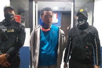 Las cadenas que quiso tragarse el sospechoso están valoradas en 8.500 dólares cada una.