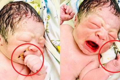 Este bebé puede ser considerado un error estadístico. Conoce por qué en su historia.