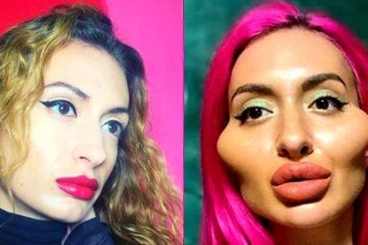 Anastasiia Pokreshchuk en dos imágenes: la de la izquierda es de hace un año, la de la derecha es una foto actual.