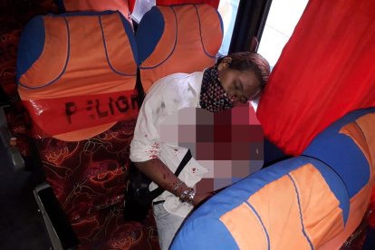 Así quedó Juan Álvarez luego de recibir varios tiros dentro de un carro.