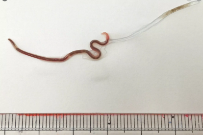 El gusano 'Pseudoterranova azarasi' mudando la cutícula externa.