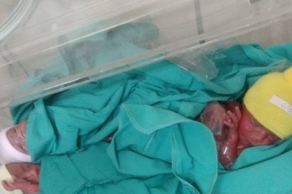 El nacimiento de Victoria, Julieta y Delfina Chainski es algo insólito y varios medios argentinos han cubierto la noticia.