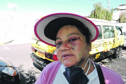 A Mayra Troya le desfiguraron el rostro por pedir respeto al toque de 
queda.