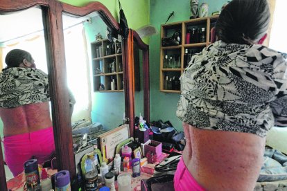 Las excoriaciones se extienden por casi todo su cuerpo. La falta de tratamiento aumenta los dolores que tiene.