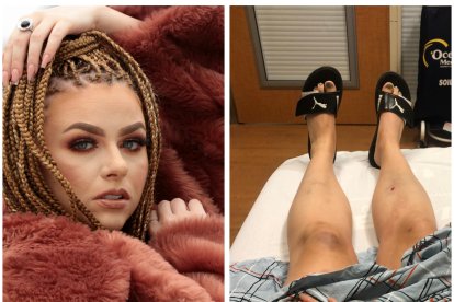 Christina se dirigía a su trabajo cuando sufrió el terrible siniestro. Actualmente se recupera de sus lesiones.