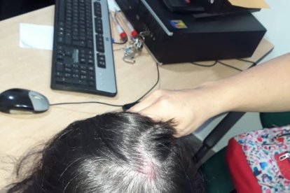 La joven, de 19 años, recibió un golpe en la cabeza que la dejó inconsciente.