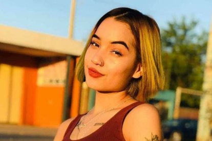 Las llamas habían cubierto el 45% del cuerpo de la jovencita.