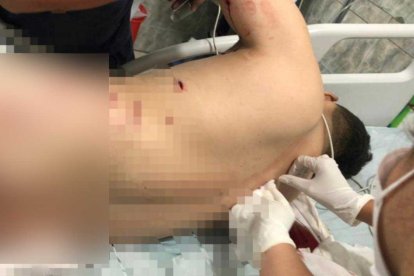 Los perdigones impactaron en la espalda del agente.