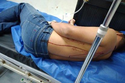 El acompañante de la joven resultó con un balazo en la espalda.