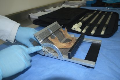 Con la medición de huesos se puede conocer el sexo del cadáver y un aproximado de edad.