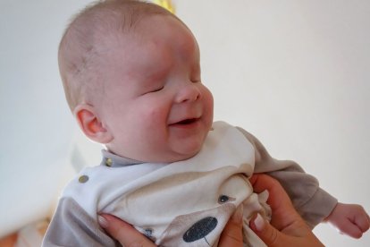 Los médicos afirman que, desafortunadamente, el niño nunca podrá ver.