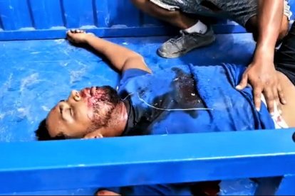 El venezolano Jesús Gregorio Rodríguez Avalo fue baleado en el límite fronterizo.