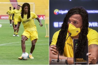 La gente se imaginó cómo luciría Aimar con su implante de cabello.