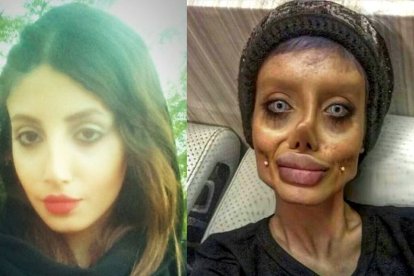 La mujer iraní antes y después de las cirugías plásticas que le cambiaron el rostro de manera profunda.