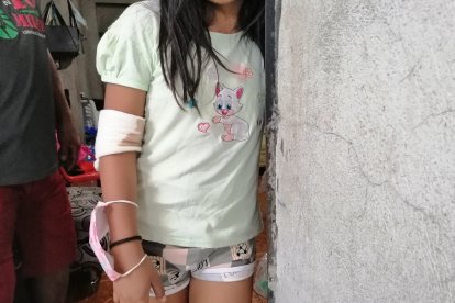 Una niña, de 9 años, resultó con una herida leve en un brazo.