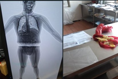 La verificación con rayos X permitió descubrir la droga