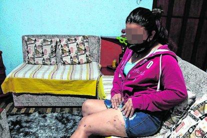 La chica usó sus piernas para protegerse del ataque y también resultaron lastimadas.