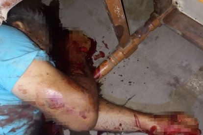 El cadáver fue trasladado hasta el Centro Forense de Manta.